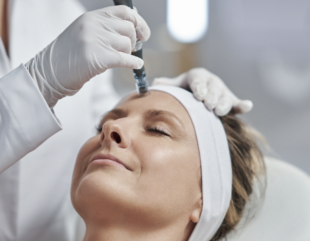 Microneedling behandling